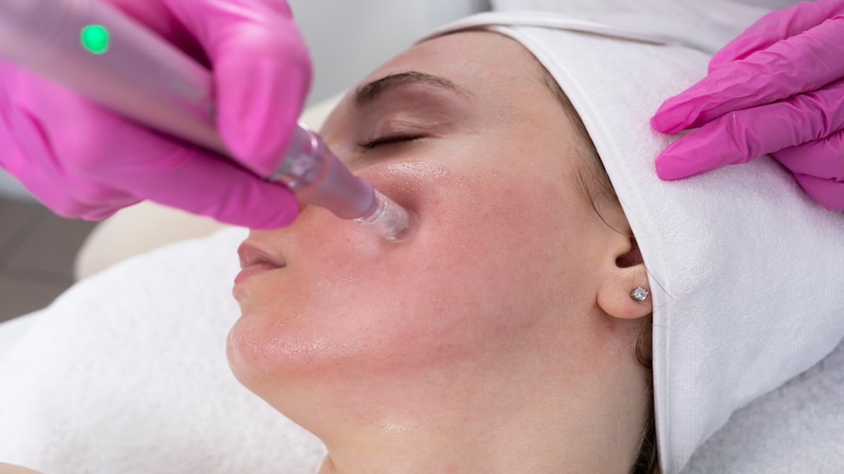 dermapen OEM manufacturer selection